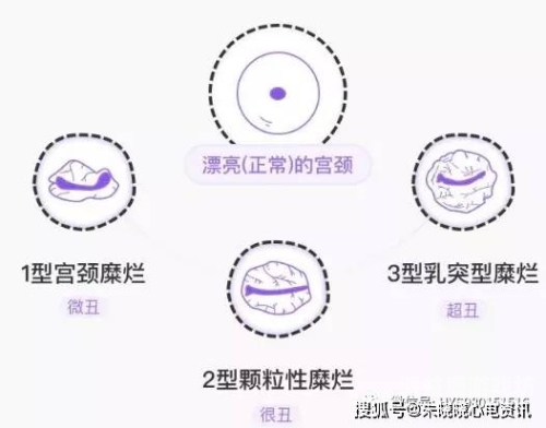舔吸乳头操免费视频，解锁女性健康新姿势