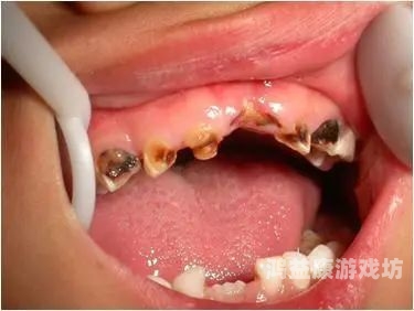 娇喘视频，揭秘胸大美女的神秘世界牙齿很多烂了怎么办
